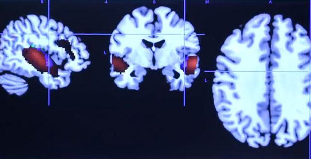 brain dogs and humans cerebro-dogs-and-human